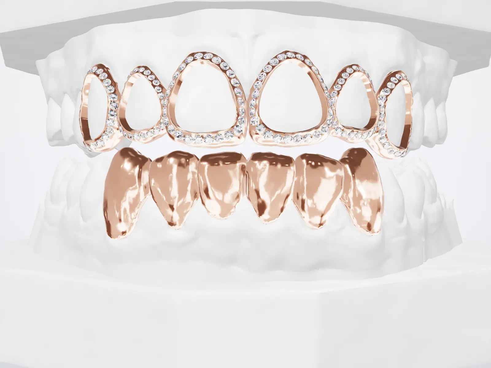 Rose gold open window caps lined with stones on top, plain caps below